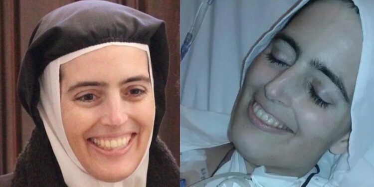 സഹന തീച്ചൂളയില്‍ പുഞ്ചിരിച്ച് യാത്രയായ സിസ്റ്റര്‍ സിസിലിയയുടെ നാമകരണ നടപടികള്‍ മുന്നോട്ട്